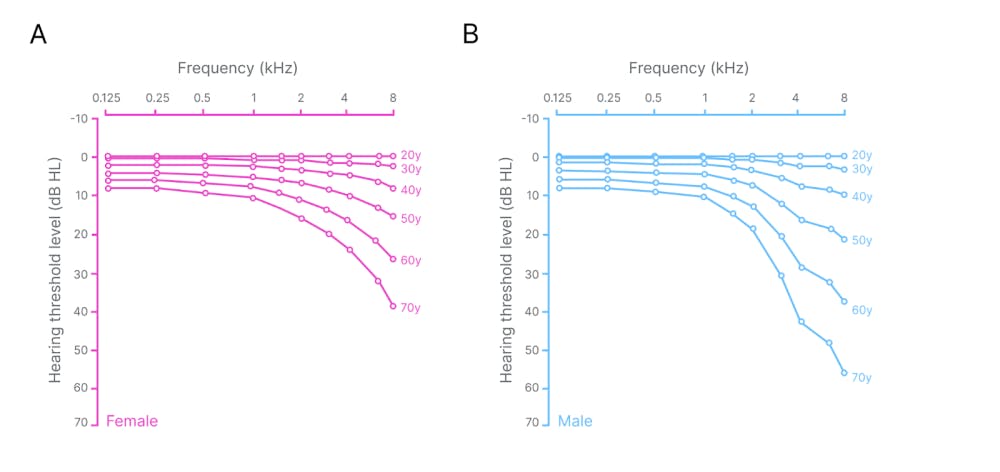 Four smartphone screens showing the user interface of a sound personalization app. The screens display headphone setup instructions, a sound preference selection test, a hearing balance assessment graph, and a confirmation screen for the updated SoundID profile.